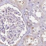 CAP2 Antibody in Immunohistochemistry (IHC)