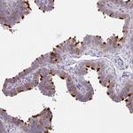 DNAI2 Antibody in Immunohistochemistry (IHC)