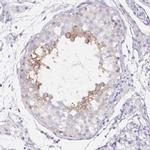 DNAI2 Antibody in Immunohistochemistry (IHC)