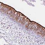 DNAI2 Antibody in Immunohistochemistry (IHC)