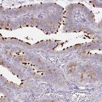 DNAI2 Antibody in Immunohistochemistry (IHC)