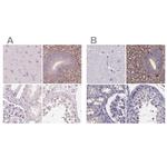 SFRP4 Antibody in Immunohistochemistry (IHC)