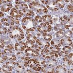 FAM170B Antibody in Immunohistochemistry (Paraffin) (IHC (P))