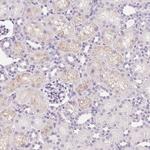 IGFBP-1 Antibody in Immunohistochemistry (Paraffin) (IHC (P))