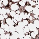 HMBS Antibody in Immunohistochemistry (Paraffin) (IHC (P))