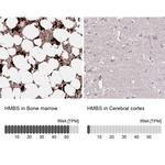 HMBS Antibody in Immunohistochemistry (IHC)