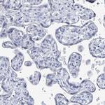 NTN3 Antibody in Immunohistochemistry (Paraffin) (IHC (P))