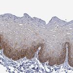 NTN3 Antibody in Immunohistochemistry (Paraffin) (IHC (P))