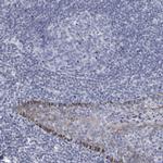 NTN3 Antibody in Immunohistochemistry (Paraffin) (IHC (P))