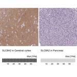 SLC8A2 Antibody in Immunohistochemistry (IHC)