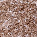 BDKRB2 Antibody in Immunohistochemistry (Paraffin) (IHC (P))