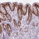 BDKRB2 Antibody in Immunohistochemistry (Paraffin) (IHC (P))