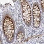 C10orf99 Antibody in Immunohistochemistry (Paraffin) (IHC (P))