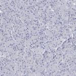 C10orf99 Antibody in Immunohistochemistry (Paraffin) (IHC (P))