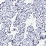 C10orf99 Antibody in Immunohistochemistry (Paraffin) (IHC (P))