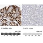 C10orf99 Antibody in Immunohistochemistry (IHC)