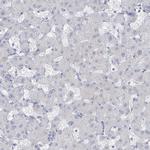 C10orf99 Antibody in Immunohistochemistry (IHC)