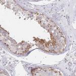 MAP1S Antibody in Immunohistochemistry (IHC)