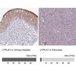 LYPLA1 Antibody in Immunohistochemistry (IHC)