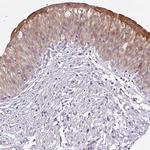 LYPLA1 Antibody in Immunohistochemistry (IHC)