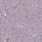 LYPLA1 Antibody in Immunohistochemistry (IHC)