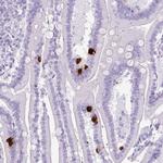 Secretin Antibody in Immunohistochemistry (Paraffin) (IHC (P))