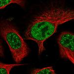 UCK1 Antibody in Immunocytochemistry (ICC/IF)