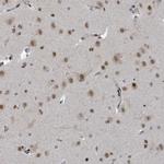 UCK1 Antibody in Immunohistochemistry (Paraffin) (IHC (P))