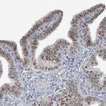 UCK1 Antibody in Immunohistochemistry (Paraffin) (IHC (P))