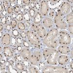 UCK1 Antibody in Immunohistochemistry (Paraffin) (IHC (P))