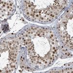 UCK1 Antibody in Immunohistochemistry (Paraffin) (IHC (P))