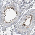 SLC44A5 Antibody in Immunohistochemistry (Paraffin) (IHC (P))