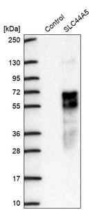 SLC44A5 Antibody in Western Blot (WB)