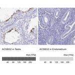 ACSBG2 Antibody in Immunohistochemistry (IHC)