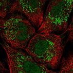 KCNH3 Antibody in Immunocytochemistry (ICC/IF)