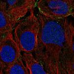 KANK3 Antibody in Immunocytochemistry (ICC/IF)