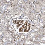 KANK3 Antibody in Immunohistochemistry (Paraffin) (IHC (P))