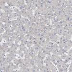 KANK3 Antibody in Immunohistochemistry (Paraffin) (IHC (P))