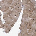 KANK3 Antibody in Immunohistochemistry (Paraffin) (IHC (P))