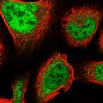 ZNF281 Antibody in Immunocytochemistry (ICC/IF)