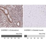 SAM68 Antibody in Immunohistochemistry (IHC)