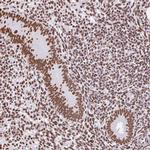 SAM68 Antibody in Immunohistochemistry (IHC)