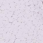 SAM68 Antibody in Immunohistochemistry (IHC)