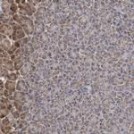 MTMR12 Antibody in Immunohistochemistry (Paraffin) (IHC (P))