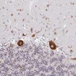 LARP1 Antibody in Immunohistochemistry (Paraffin) (IHC (P))