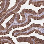 LARP1 Antibody in Immunohistochemistry (Paraffin) (IHC (P))