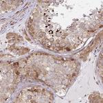 LARP1 Antibody in Immunohistochemistry (Paraffin) (IHC (P))