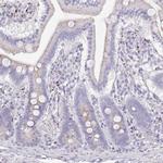 SRD5A1 Antibody in Immunohistochemistry (Paraffin) (IHC (P))