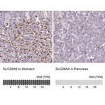 SLC26A9 Antibody in Immunohistochemistry (IHC)