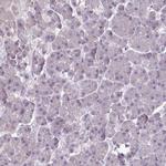 SLC26A9 Antibody in Immunohistochemistry (IHC)